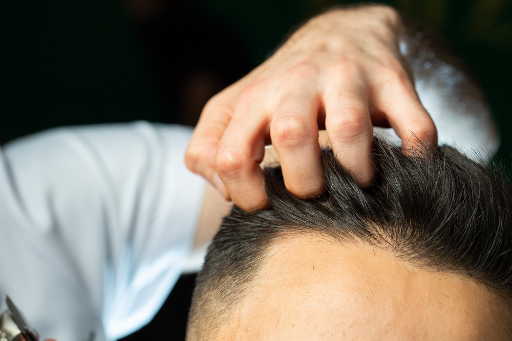 Injerto capilar en Valencia: soluciones avanzadas para recuperar tu cabello de forma natural